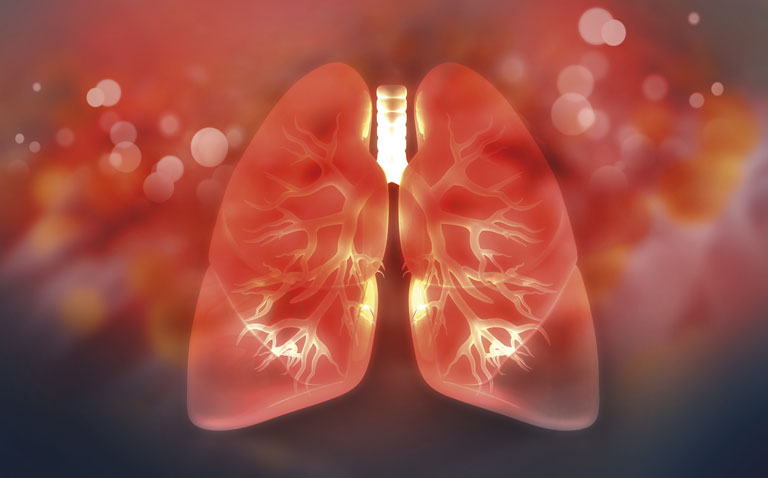 Endoscopic lung volume reduction in COPD