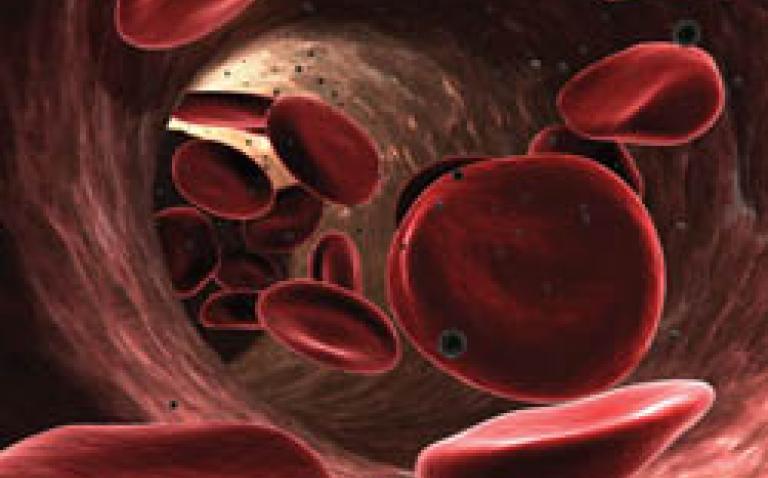 NICE draft guidance recommends apixaban for treating and preventing potentially fatal blood clots