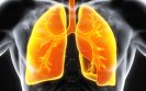 World’s first clinical guidelines for chronic fungal lung infections