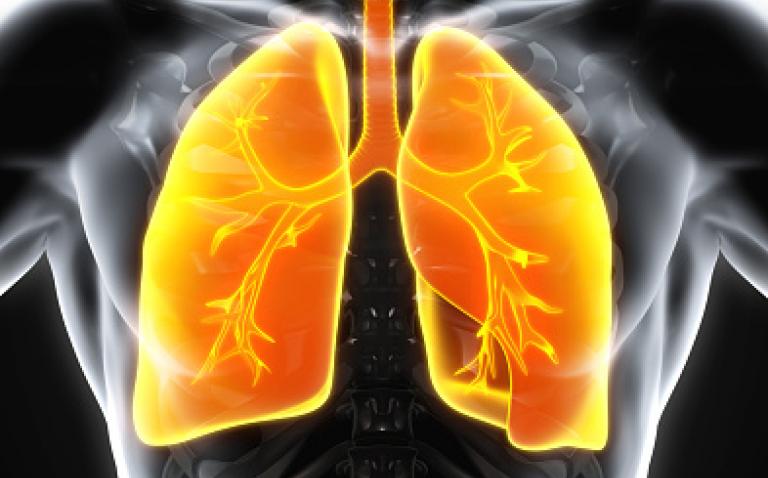 World’s first clinical guidelines for chronic fungal lung infections