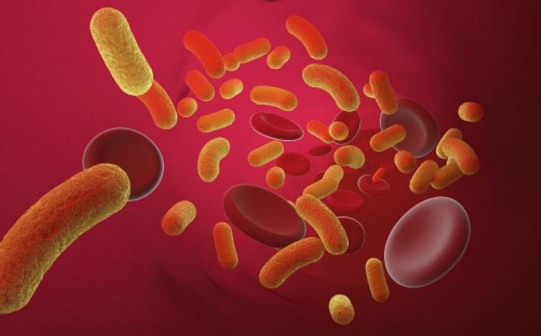 Women more likely to die within 30-days from bacterial blood infection