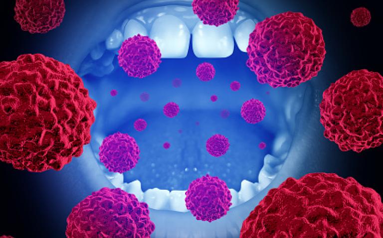 Lymphoseek may be alternative to elective neck dissection to stage oral cancer.