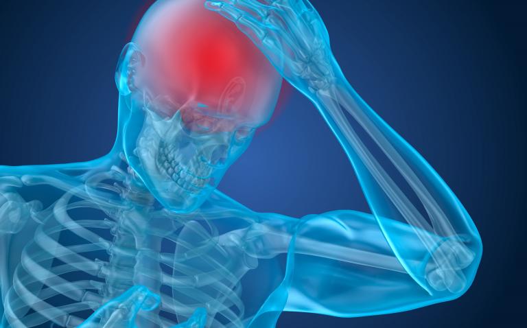 New study to help improve life for headache sufferers