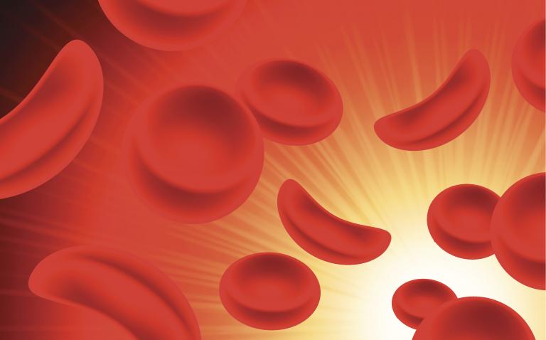 Oral glutamine under assessment by EMA for sickle cell disease
