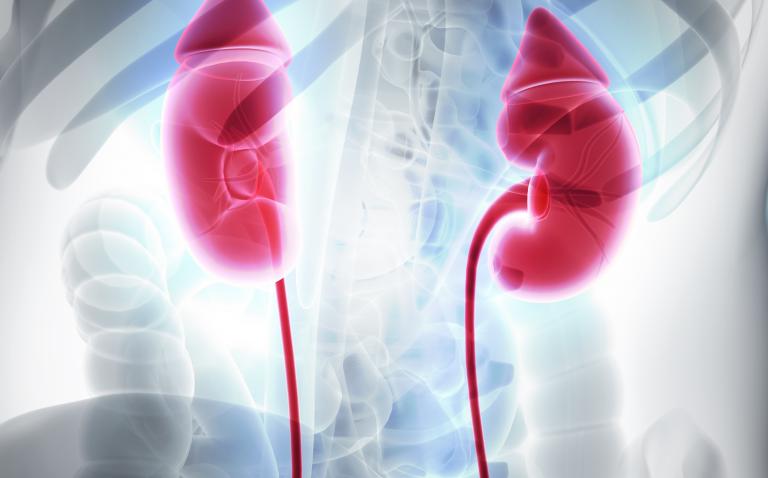 'Killer' kidney cancers identified by studying their evolution
