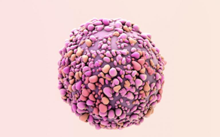 Drug trial to investigate anti-tumour effect on patients with metastatic breast cancer