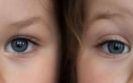 Identical twins light the way for new genetic cause of inflammatory arthritis
