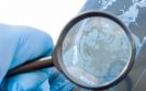 Patients' own cells could be the key to treating Crohn's disease