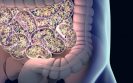 Study shows that lupus is strongly linked to imbalances in gut microbiome