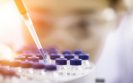 Inhibiting cancer-causing protein could prevent scleroderma fibrosis