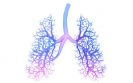 Dupilumab label expanded for severe asthma indication
