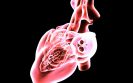 First study in PAH using cardiac MRI as a primary endpoint presented
