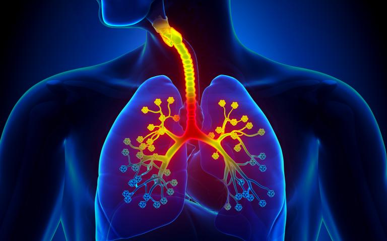 Bronchiectasis associated with high frequency of allergy