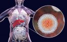 Hep C infections could be prevented worldwide by reducing transmission in people who inject drugs
