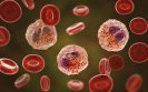 High-tech tissue study reveals which cells drive a painful food allergy