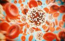 HER2 positive breast cancer: treatment de-escalation needs to be personalised