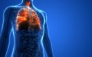 First patients for UK ‘chronic pain’ trial