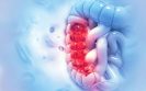 Using 3D to test personalised cancer treatments in five days