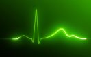 New biomarkers for cardiovascular risk in juvenile-onset SLE