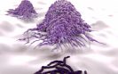 Research highlights possible targets to help tackle Crohn's disease