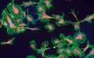 Repurposing drugs or combining therapies could help in treating autoimmune disease