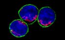 Distinguishing helpful and harmful gut immune cells offers new view on inflammatory diseases