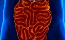 Blood pressure drugs may be linked with increased risk of bowel condition