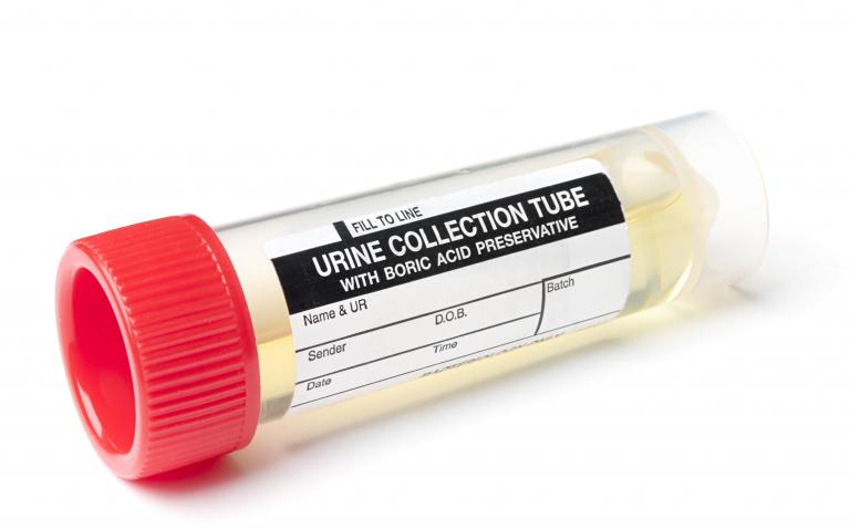 Urine test could offer a non-invasive approach for diagnosis of IBS