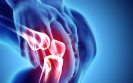Osteoarthritis linked to higher risk of dying from cardiovascular disease