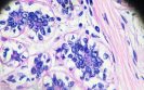 Ribociclib receives NICE recommendation