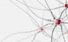 Study pinpoints cell types affected in brains of multiple sclerosis patients