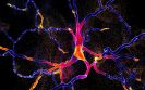 UK charity announces research investment to find Parkinson’s drug