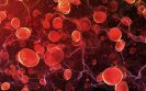 Blood clotting proteins in urine discovered as biomarkers of lupus nephritis