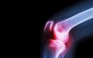 Joint lubricating fluid plays key role in osteoarthritic pain