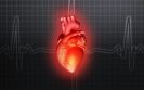 'Typical' heart attack symptoms more likely in women than men