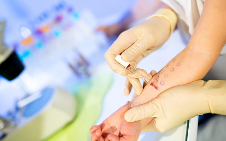 Expert view: Summing up skin prick testing
