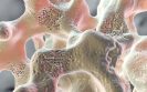 Experts consider osteoporosis to be a silent epidemic
