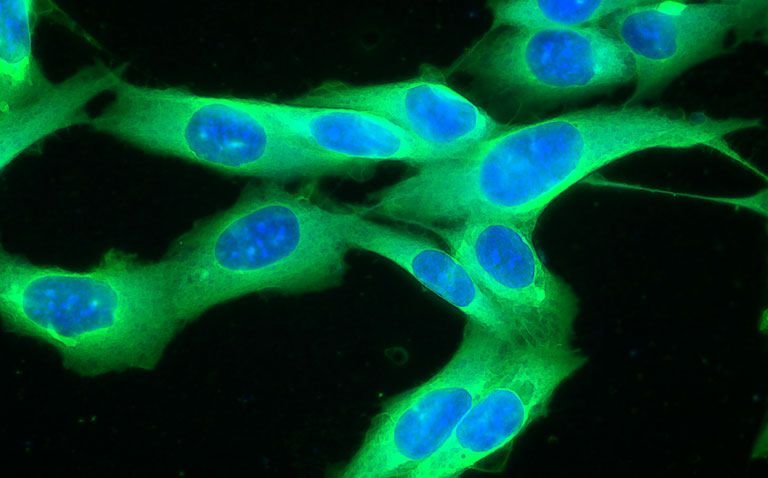 Vitamin influences signalling behaviour in melanoma cells
