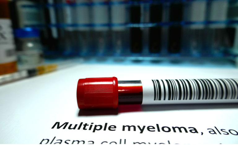 New treatment option for transplant-ineligible multiple myeloma patients