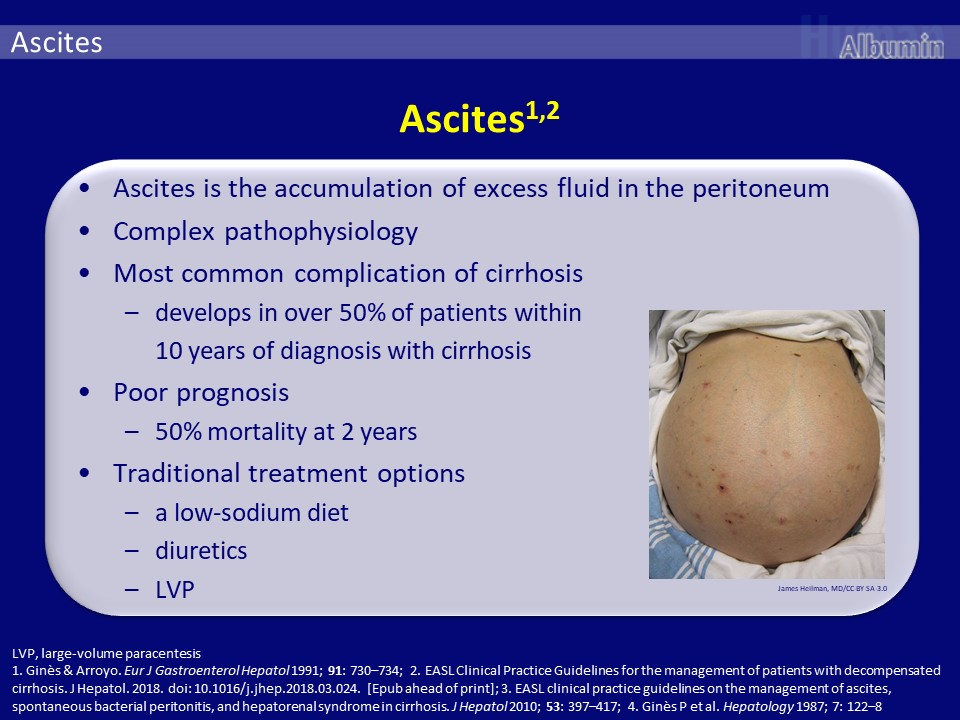 Albumin in hepatology: an educational slide set - Hospital Healthcare ...