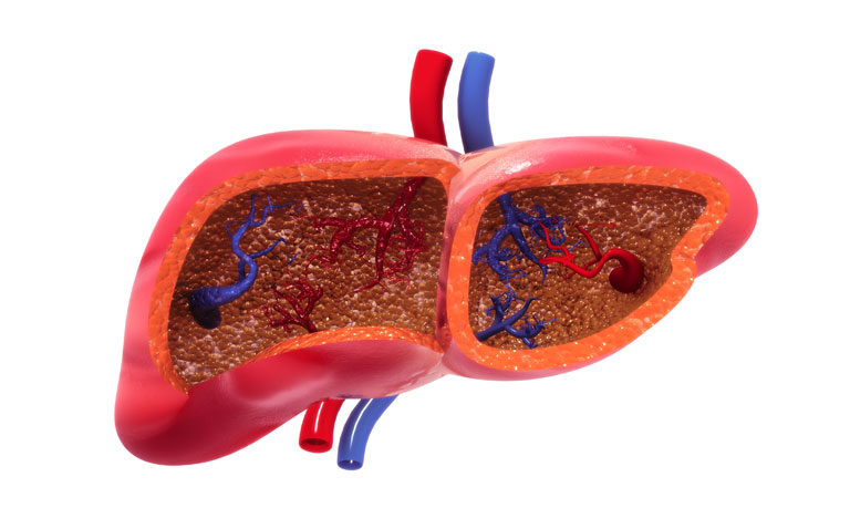 Redefining non-alcoholic fatty liver disease