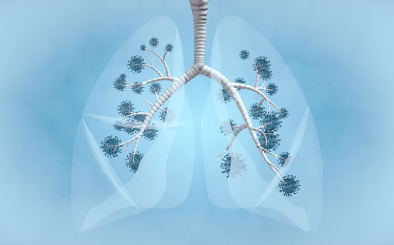 Are patients with asthma protected against COVID-19?