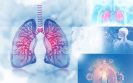 lung cancer services and COVID