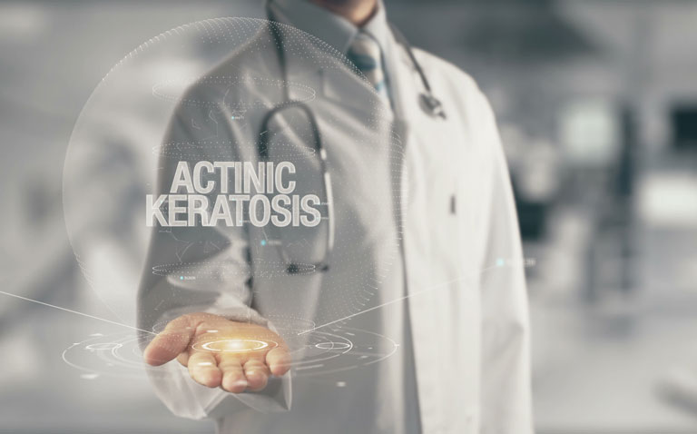Increased risk of squamous cell cancer in those diagnosed with actinic keratoses