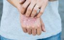 NMA and biologics in plaque psoriasis