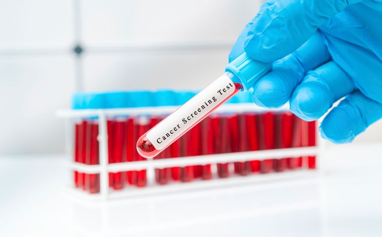 Multi-cancer early detection blood test highly accurate
