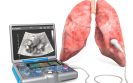 ERS best practice guidance on lung US