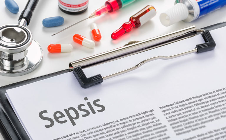 Machine learning model predictive of mortality in sepsis