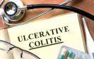 biomarkers ulcerative colitis