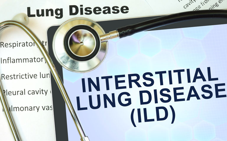 interstitial lung disease